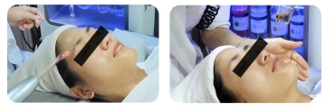 เครื่องสังเคราะห์ฟองขนาดใหญ่สำหรับใบหน้า เครื่องเสริมสวยฟองใหญ่ เครื่องมือครบวงจร เครื่องมือจัดการผิว ทำความสะอาดใบหน้า ดูดสิวหัวดำ แนะนำเครื่องมือเสริมสวย ร้านเสริมสวย