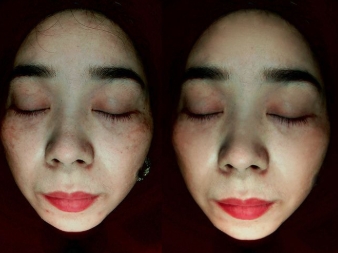เครื่องตรวจจับผิวหน้าอัจฉริยะ AI ของ Beauty Big Move เครื่องตรวจจับกระจกวิเศษ Moji วิเคราะห์ผิวร้านเสริมสวย