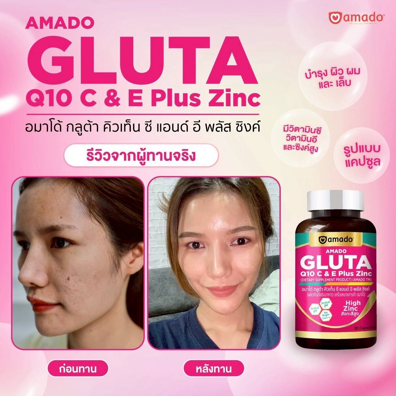 AMADO GLUTA Q10 C & E Plus Zinc, อมาโด้ กลูต้า คิวเท็น ซี แอนด์ อี พลัส ซิงค์, AMADO GLUTA Q10, อมาโด้ กลูต้า คิวเท็น, AMADO GLUTA Q10 ราคา, อมาโด้ กลูต้า คิวเท็น ราคา, AMADO GLUTA Q10 รีวิว, อมาโด้ กลูต้า คิวเท็น รีวิว, AMADO GLUTA Q10 ผิวใส, อมาโด้ กลูต้า คิวเท็น ผิวใส