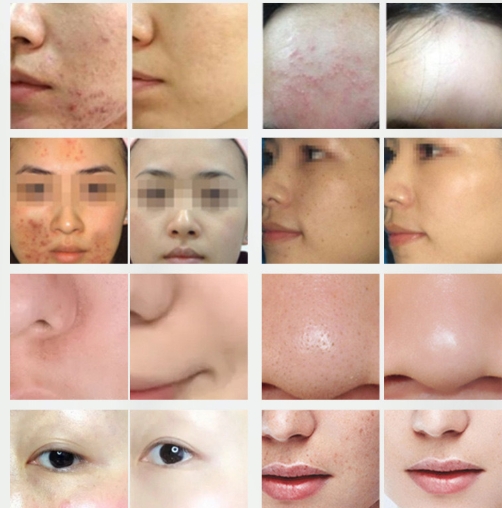 เครื่องมือฟื้นฟูผิวแบบสเปรย์สเปกโตรมิเตอร์สปาโฟแบบร้อนและเย็นรุ่นใหม่พร้อมไฟ LED 7 สี