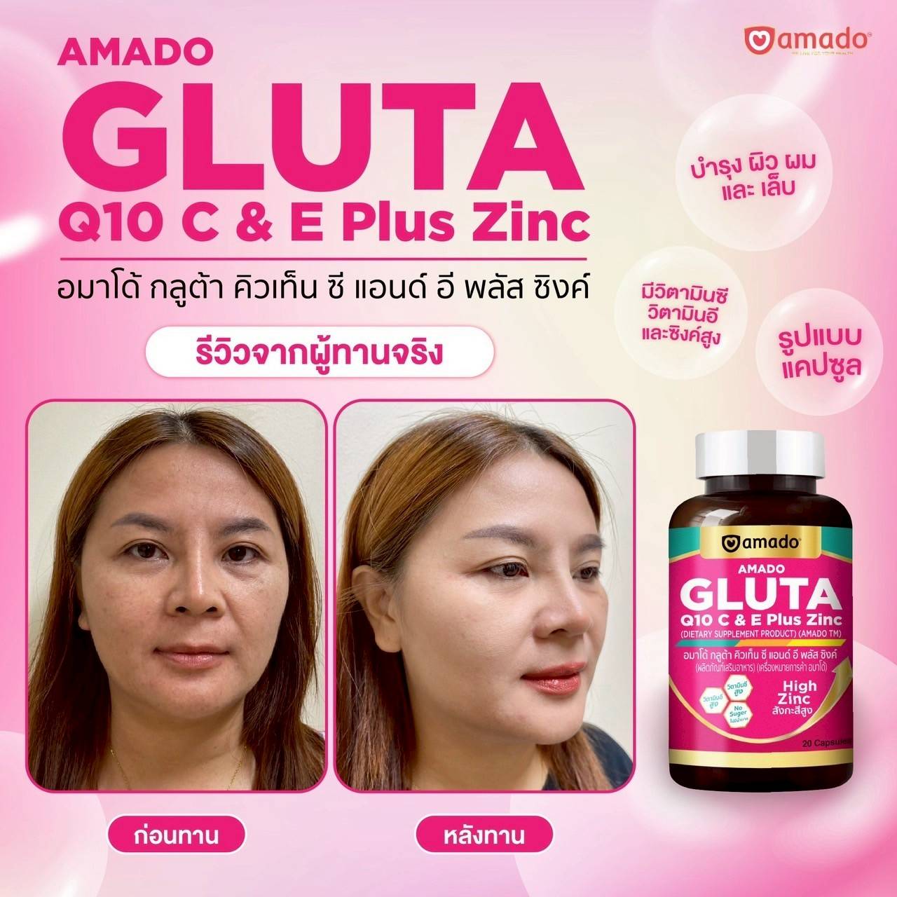 AMADO GLUTA Q10 C & E Plus Zinc, อมาโด้ กลูต้า คิวเท็น ซี แอนด์ อี พลัส ซิงค์, AMADO GLUTA Q10, อมาโด้ กลูต้า คิวเท็น, AMADO GLUTA Q10 ราคา, อมาโด้ กลูต้า คิวเท็น ราคา, AMADO GLUTA Q10 รีวิว, อมาโด้ กลูต้า คิวเท็น รีวิว, AMADO GLUTA Q10 ผิวใส, อมาโด้ กลูต้า คิวเท็น ผิวใส