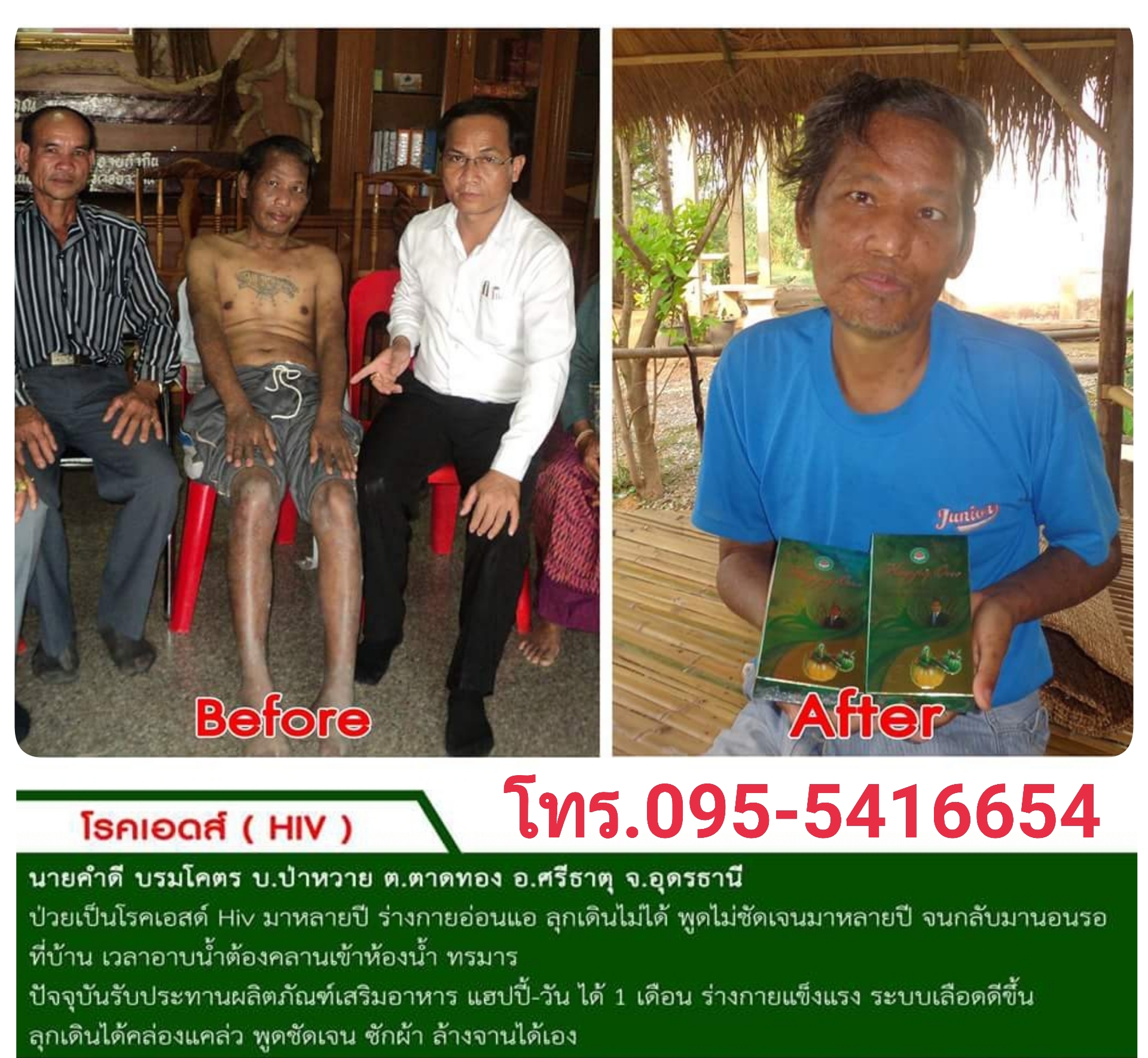 เชื้อรากินแฮปปี้วัน โรคผิวหน้งทานแฮปปี้วัน