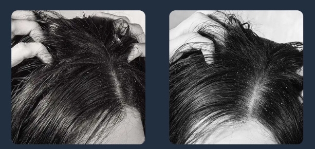 เครื่องตรวจจับผิวหนังและเส้นผมแบบมัลติฟังก์ชั่น เครื่องตรวจจับหนังศีรษะความละเอียดสูง เครื่องทดสอบเส้นผมในรูขุมขน เครื่องขยายสัญญาณแบบบูรณาการ เครื่องมือดูแลร้านตัดผม