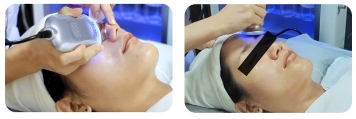 เครื่องสังเคราะห์ฟองขนาดใหญ่สำหรับใบหน้า เครื่องเสริมสวยฟองใหญ่ เครื่องมือครบวงจร เครื่องมือจัดการผิว ทำความสะอาดใบหน้า ดูดสิวหัวดำ แนะนำเครื่องมือเสริมสวย ร้านเสริมสวย