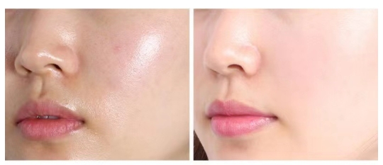 เครื่องฉีดละอองน้ำสำหรับใบหน้า เครื่องฉีดออกซิเจนแสงสีแดงและสีน้ำเงิน เครื่องพ่นออกซิเจนแรงดันสูงแบบพกพา เครื่องฉีดออกซิเจนแบบละอองน้ำขนาดใหญ่และละเอียดอ่อน เครื่องมือเสริมความงามด้วยออกซิเจน